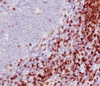 CD5 Antibody - Formalin-fixed, paraffin-embedded human tonsil stained with anti-CD5 antibody (SPM546).  This image was taken for the unmodified form of this product. Other forms have not been tested.