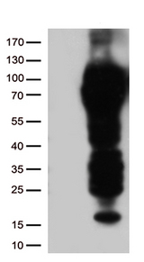 CD5 Antibody - HEK293T cells were transfected with the pCMV6-ENTRY control. (Left lane) or pCMV6-ENTRY CD5. (Right lane) cDNA for 48 hrs and lysed. Equivalent amounts of cell lysates. (5 ug per lane) were separated by SDS-PAGE and immunoblotted with anti-CD5. (1:500)