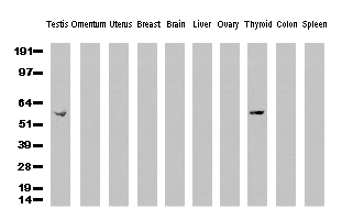 CD5 Antibody - Western Blot analysis of 10 different human tissue lysates. (10ug) by using anti-CD5 monoclonal antibody. (clone UMAB9, 1:500)