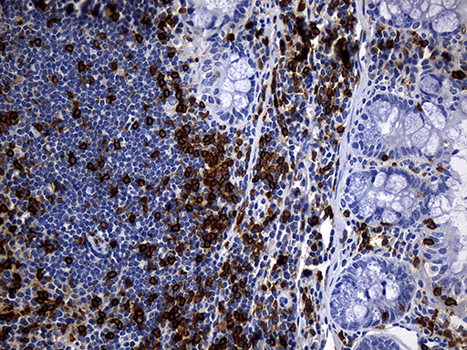 CD5 Antibody - Immunohistochemical staining of paraffin-embedded mouse ascending colon tissue using anti-CD5 clone UMAB9 mouse monoclonal antibody. (Heat-induced epitope retrieval by 1mM EDTA in 10mM Tris buffer. (pH8.5) at 120°C for 3 min. (1:300).