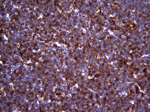 CD5 Antibody - Immunohistochemical staining of paraffin-embedded mouse thymus tissue using anti-CD5 clone UMAB9 mouse monoclonal antibody. (Heat-induced epitope retrieval by 1mM EDTA in 10mM Tris buffer. (pH8.5) at 120°C for 3 min. (1:300).
