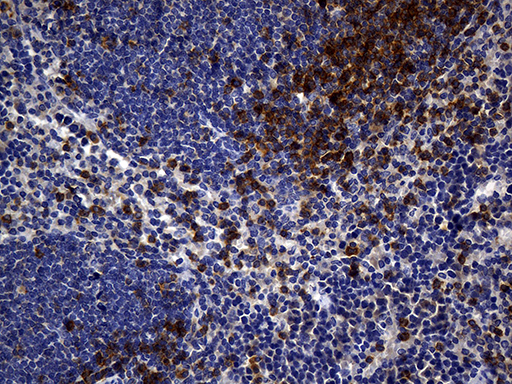 CD5 Antibody - Immunohistochemical staining of paraffin-embedded mouse spleen tissue using anti-CD5 clone UMAB9 mouse monoclonal antibody. (Heat-induced epitope retrieval by 1mM EDTA in 10mM Tris buffer. (pH8.5) at 120 oC for 3 min. (1:300).