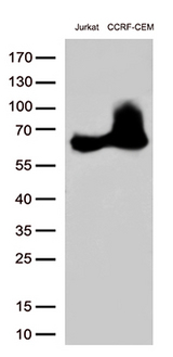 CD5 Antibody - Western blot analysis of extracts. (35ug) from 2 cell lines lysates by using anti-CD5 monoclonal antibody. (1:500)
