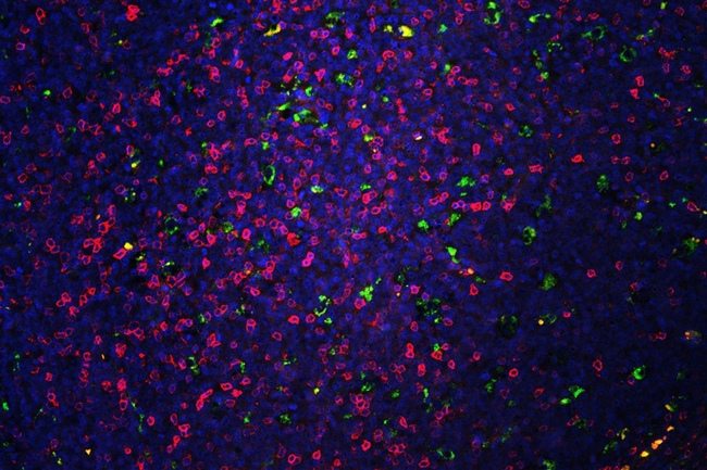 CD5 Antibody - IF analysis of CD68 and CD5 using anti-CD68 antibody (M00602) and anti-CD5 antibody CD68 and CD5 was detected in paraffin-embedded section of rat brain tissues. Heat mediated antigen retrieval was performed in citrate buffer (pH6, epitope retrieval solution) for 20 mins. The tissue section was blocked with 10% goat serum. The tissue section was then incubated with 1µg/mL rabbit anti-CD68 antibody (M00602) and anti-CD5 antibody overnight at 4°C. DyLight488 Conjugated Goat Anti-Mouse IgG and Biotin conjugated goat anti-rabbit IgG was used as secondary antibody at 1:100 dilution and incubated for 30 minutes at 37°C. The tissue section was developed using DyLight®488 Conjugated Avidin (BA1128). The section was counterstained with DAPI. Visualize using a fluorescence microscope and filter sets appropriate for the label used.