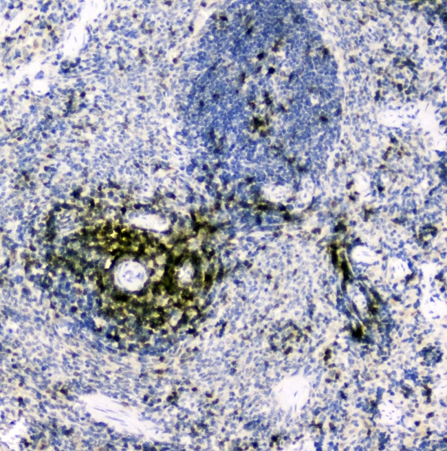 CD5 Antibody - IHC analysis of CD5 using anti-CD5 antibody. CD5 was detected in paraffin-embedded section of rat spleen tissues. Heat mediated antigen retrieval was performed in citrate buffer (pH6, epitope retrieval solution) for 20 mins. The tissue section was blocked with 10% goat serum. The tissue section was then incubated with 2µg/ml rabbit anti-CD5 Antibody overnight at 4°C. Biotinylated goat anti-rabbit IgG was used as secondary antibody and incubated for 30 minutes at 37°C. The tissue section was developed using Strepavidin-Biotin-Complex (SABC) with DAB as the chromogen.