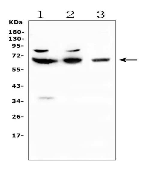 CD5 Antibody - Western blot analysis of CD5 using anti-CD5 antibody. Electrophoresis was performed on a 5-20% SDS-PAGE gel at 70V (Stacking gel) / 90V (Resolving gel) for 2-3 hours. The sample well of each lane was loaded with 50ug of sample under reducing conditions. Lane 1: human Jurkat whole cell lysates,Lane 2: human CCRF-CEM whole cell lysates,Lane 3: mouse NIH3T3 whole cell lysates. After Electrophoresis, proteins were transferred to a Nitrocellulose membrane at 150mA for 50-90 minutes. Blocked the membrane with 5% Non-fat Milk/ TBS for 1.5 hour at RT. The membrane was incubated with rabbit anti-CD5 antigen affinity purified polyclonal antibody at 0.5 ?g/mL overnight at 4?C, then washed with TBS-0.1% Tween 3 times with 5 minutes each and probed with a goat anti-rabbit IgG-HRP secondary antibody at a dilution of 1:10000 for 1.5 hour at RT. The signal is developed using an Enhanced Chemiluminescent detection (ECL) kit with Tanon 5200 system. A specific band was detected for CD5 at approximately 67KD. The expected band size for CD5 is at 54KD.