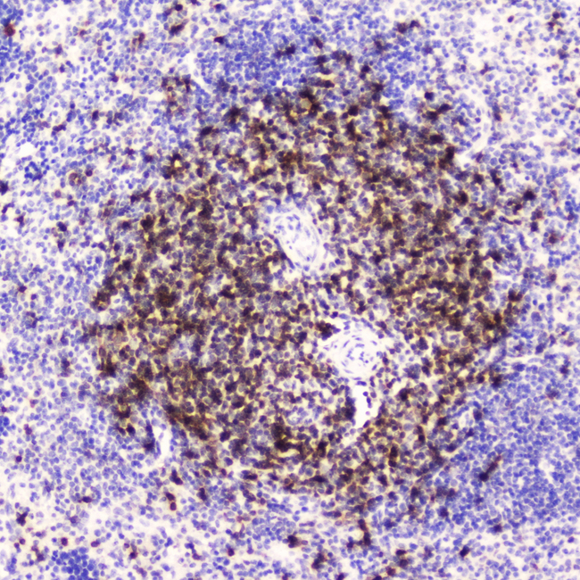 CD5 Antibody - IHC analysis of CD5 using anti-CD5 antibody. CD5 was detected in paraffin-embedded section of mouse spleen tissue . Heat mediated antigen retrieval was performed in citrate buffer (pH6, epitope retrieval solution) for 20 mins. The tissue section was blocked with 10% goat serum. The tissue section was then incubated with 2?g/ml rabbit anti-CD5 Antibody overnight at 4?C. Biotinylated goat anti-rabbit IgG was used as secondary antibody and incubated for 30 minutes at 37?C. The tissue section was developed using Strepavidin-Biotin-Complex (SABC) with DAB as the chromogen.