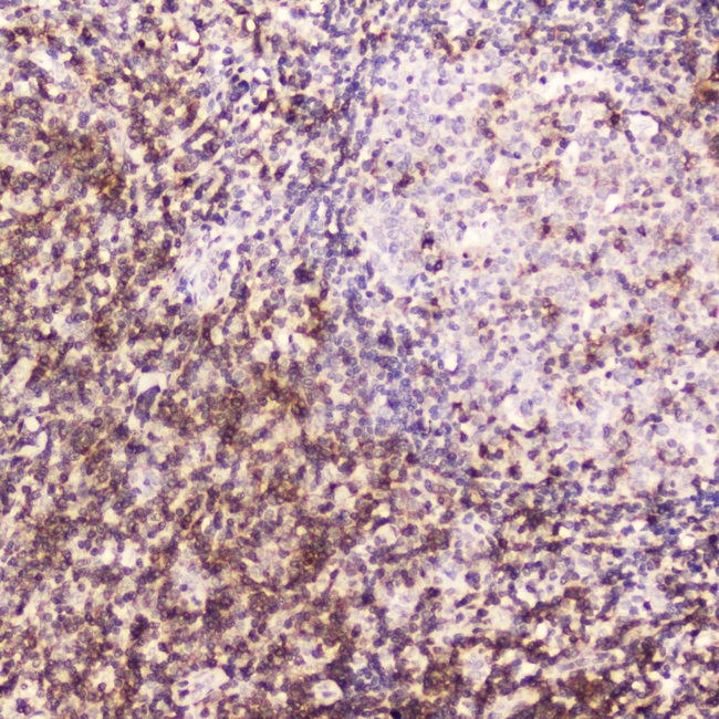 CD5 Antibody - IHC analysis of CD5 using anti-CD5 antibody. CD5 was detected in paraffin-embedded section of human tonsil tissue . Heat mediated antigen retrieval was performed in citrate buffer (pH6, epitope retrieval solution) for 20 mins. The tissue section was blocked with 10% goat serum. The tissue section was then incubated with 2?g/ml rabbit anti-CD5 Antibody overnight at 4?C. Biotinylated goat anti-rabbit IgG was used as secondary antibody and incubated for 30 minutes at 37?C. The tissue section was developed using Strepavidin-Biotin-Complex (SABC) with DAB as the chromogen.