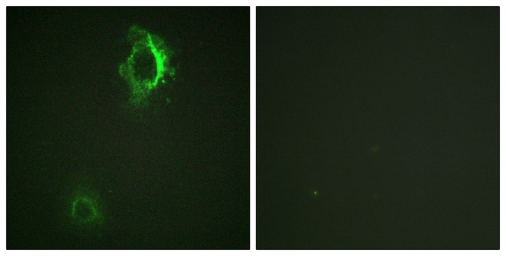 CD5 Antibody - Immunofluorescence analysis of HepG2 cells, using CD5 (Phospho-Tyr453) Antibody. The picture on the right is blocked with the phospho peptide.