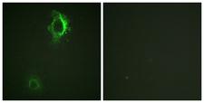 CD5 Antibody - Immunofluorescence analysis of HepG2 cells, using CD5 (Phospho-Tyr453) Antibody. The picture on the right is blocked with the phospho peptide.
