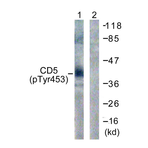 CD5 Antibody - Western blot analysis of lysates from 293 cells treated with PMA 125ng/ml 30' , using CD5 (Phospho-Tyr453) Antibody. The lane on the right is blocked with the phospho peptide.