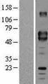 CD5 Protein - Western validation with an anti-DDK antibody * L: Control HEK293 lysate R: Over-expression lysate