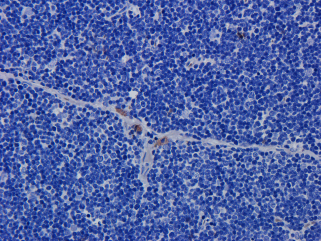 CD52 Antibody - IF staining of rat thymus.