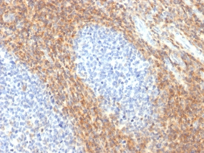 CD52 Antibody - Formalin-fixed, paraffin-embedded Human Tonsil stained with CD52 Rabbit Recombinant Monoclonal Antibody (CD52/2276R).
