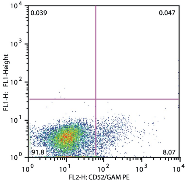 CD52 Antibody - Flow cytometry analysis of CD52 in patients suffering with Acute Lymphoblastic Leukemia (anti-human CD52 (HI186); detection by Goat anti-mouse IgG2b PE).  Fig. 1A – CD52 negative pro T ALL (gate leukemic cells)  Fig. 1B – CD52 positive cALL (gate leukemic cells)
