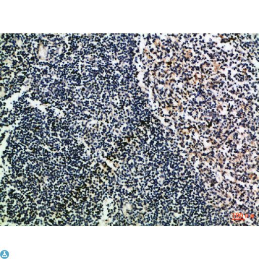 CD52 Antibody - Immunohistochemical analysis of paraffin-embedded Human-tonsil, antibody was diluted at 1:100.
