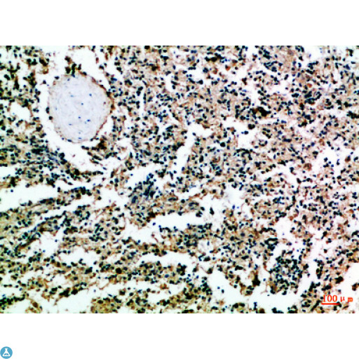 CD52 Antibody - Immunohistochemical analysis of paraffin-embedded Human-spleen, antibody was diluted at 1:100.