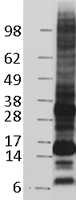 CD52 Protein - Western validation with an anti-DDK antibody * L: Control HEK293 lysate R: Over-expression lysate