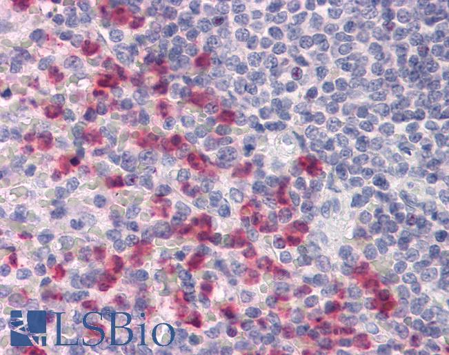 CD53 Antibody - Anti-CD53 antibody IHC of human spleen. Immunohistochemistry of formalin-fixed, paraffin-embedded tissue after heat-induced antigen retrieval. Antibody concentration 10 ug/ml.  This image was taken for the unconjugated form of this product. Other forms have not been tested.