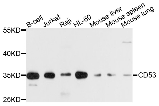 CD53 Antibody - Western blot analysis of extracts of various cell lines, using CD53 antibody at 1:1000 dilution. The secondary antibody used was an HRP Goat Anti-Rabbit IgG (H+L) at 1:10000 dilution. Lysates were loaded 25ug per lane and 3% nonfat dry milk in TBST was used for blocking. An ECL Kit was used for detection and the exposure time was 1s.