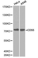 CD55 Antibody - Western blot of CD55 pAb in extracts from Hela and A549 cells.