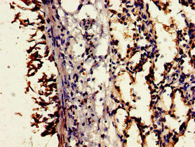 CD55 Antibody - Immunohistochemistry image of paraffin-embedded human lung tissue at a dilution of 1:100