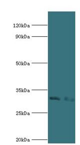 CD58 Antibody - Western blot. All lanes: Lymphocyte function-associated antigen 3 antibody at 2 ug/ml. Lane 1: HeLa whole cell lysate. Lane 2: Jurkat whole cell lysate. Secondary antibody: Goat polyclonal to rabbit at 1:10000 dilution. Predicted band size: 28 kDa. Observed band size: 28 kDa.