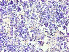 CD58 Antibody - Immunohistochemistry of paraffin-embedded human thymus tissue using antibody at 1:100 dilution.