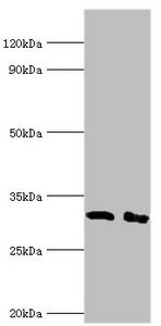 CD58 Antibody - Western blot All lanes: Lymphocyte function-associated antigen 3 antibody at 2µg/ml Lane 1: Hela whole cell lysate Lane 2: Jurkat whole cell lysate Secondary Goat polyclonal to rabbit IgG at 1/10000 dilution Predicted band size: 29, 27, 28 kDa Observed band size: 29 kDa