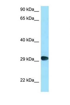 CD58 Antibody - CD58 antibody Western blot of COL0205 Cell lysate. Antibody concentration 1 ug/ml.  This image was taken for the unconjugated form of this product. Other forms have not been tested.