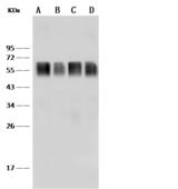 CD58 Antibody - Anti-CD58 rabbit monoclonal antibody at 1:500 dilution. Lane A: Raji Whole Cell Lysate. Lane B: Jurkat Whole Cell Lysate. Lane C: TF-1 Whole Cell Lysate. Lane D: K562 Whole Cell Lysate. Lysates/proteins at 30 ug per lane. Secondary: Goat Anti-Rabbit IgG (H+L)/HRP at 1/10000 dilution. Developed using the ECL technique. Performed under reducing conditions.
