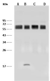 CD58 Antibody - Anti-CD58 rabbit monoclonal antibody at 1:500 dilution. Lane A: Raji Whole Cell Lysate. Lane B: Jurkat Whole Cell Lysate. Lane C: TF-1 Whole Cell Lysate. Lane D: K562 Whole Cell Lysate. Lysates/proteins at 30 ug per laneSecondaryGoat Anti-Rabbit IgG (H+L)/HRP at 1/10000 dilution. Developed using the ECL technique. Performed under reducing conditions. Predicted band size: 28 kDa.