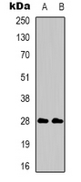 CD58 Antibody - Western blot analysis of CD58 expression in Jurkat (A); Raji (B) whole cell lysates.