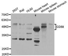 CD58 Antibody - Western blot analysis of extracts of various cell lines, using CD58 antibody.