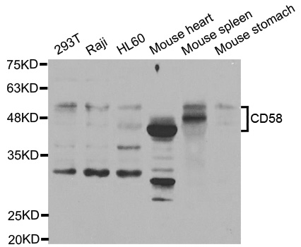 CD58 Antibody - Western blot analysis of extracts of various cell lines, using CD58 antibody.