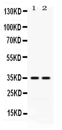 CD58 Antibody - Western blot - Anti-LFA3 Antibody