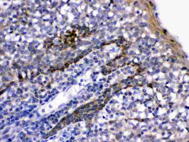 CD58 Antibody - LFA3 was detected in paraffin-embedded sections of human tonsil tissues using rabbit anti- LFA3 Antigen Affinity purified polyclonal antibody