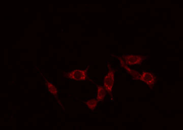 CD58 Antibody - Staining HuvEc cells by IF/ICC. The samples were fixed with PFA and permeabilized in 0.1% Triton X-100, then blocked in 10% serum for 45 min at 25°C. The primary antibody was diluted at 1:200 and incubated with the sample for 1 hour at 37°C. An Alexa Fluor 594 conjugated goat anti-rabbit IgG (H+L) Ab, diluted at 1/600, was used as the secondary antibody.