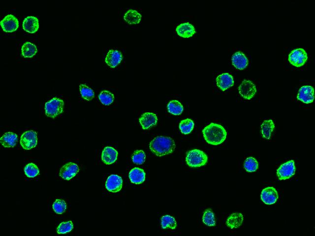 CD58 Antibody - Immunofluorescence staining of CD58 in Raji cells. Cells were fixed with 4% PFA, blocked with 10% serum, and incubated with rabbit anti-Human CD58 polyclonal antibody (dilution ratio 1:5000) at 4°C overnight. Then cells were stained with the Alexa Fluor 488-conjugated Goat Anti-rabbit IgG secondary antibody (green) and counterstained with DAPI (blue). Positive staining was localized to cell membrane.