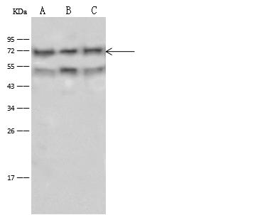 CD58 Antibody - Anti-CD58 rabbit polyclonal antibody at 1:500 dilution. Lane A: Raji Whole Cell Lysate. Lane B: Jurkat Whole Cell Lysate. Lane C: K562 Whole Cell Lysate. Lysates/proteins at 30 ug per lane. Secondary: Goat Anti-Rabbit IgG (H+L)/HRP at 1/10000 dilution. Developed using the ECL technique. Performed under reducing conditions. Predicted band size: 28 kDa. Observed band size: 72 kDa.