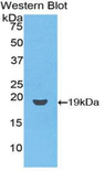 CD59 Antibody - Western blot of recombinant CD59.  This image was taken for the unconjugated form of this product. Other forms have not been tested.