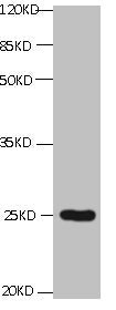 CD59 Antibody - All lanes: Mouse Anti-CD59 monoclonal antibody at 1ug/ml Lane 1:K562 Predicted band size : 15kd Observed band size : 22kd