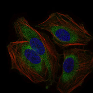 CD59 Antibody - Immunofluorescence of HeLa cells using CD59 mouse monoclonal antibody (green). Blue: DRAQ5 fluorescent DNA dye. Red: Actin filaments have been labeled with Alexa Fluor-555 phalloidin.