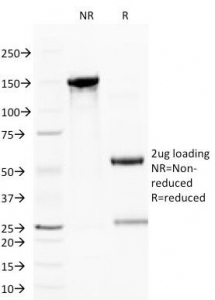 CD59 Antibody - SDS-PAGE Analysis of Purified, BSA-Free CD59 Antibody (clone BRA-10G). Confirmation of Integrity and Purity of the Antibody.