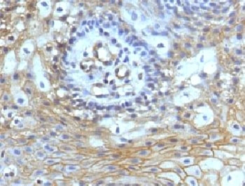 CD59 Antibody - IHC testing of FFPE human tongue with CD59 antibody (clone CDLA59-1).  This image was taken for the unmodified form of this product. Other forms have not been tested.