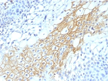 CD59 Antibody - Formalin-fixed, paraffin-embedded human tongue stained with CD59 antibody (MACIF/1193).  This image was taken for the unmodified form of this product. Other forms have not been tested.