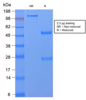 CD59 Antibody - SDS-PAGE Analysis Purified CD59 Rabbit Recombinant Monoclonal Antibody (MACIF/2867R). Confirmation of Purity and Integrity of Antibody.