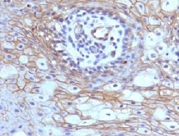 CD59 Antibody - Formalin-fixed, paraffin-embedded human tongue stained with CD59 antibody (MACIF/629).  This image was taken for the unmodified form of this product. Other forms have not been tested.