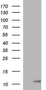 CD59 Antibody - HEK293T cells were transfected with the pCMV6-ENTRY control (Left lane) or pCMV6-ENTRY CD59 (Right lane) cDNA for 48 hrs and lysed. Equivalent amounts of cell lysates (5 ug per lane) were separated by SDS-PAGE and immunoblotted with anti-CD59.