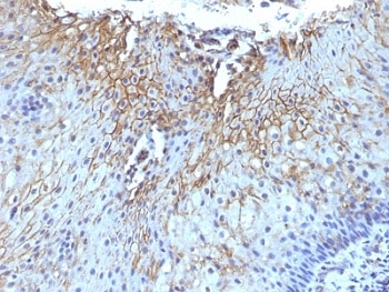 CD59 Antibody - Formalin-fixed, paraffin-embedded human tongue stained with CD59 antibody (SPM616).  This image was taken for the unmodified form of this product. Other forms have not been tested.
